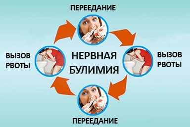 Лечение булимии в Буздяке